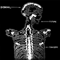 DISNIHIL - "FUTURE CANCERS" 7"